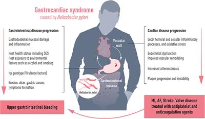 Frontiers | Gastro-Cardiology: A Novel Perspective For The ...